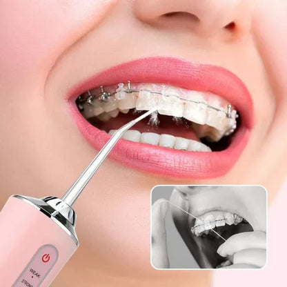 Irrigador Bucal Anti Mal Olor 😁 – Limpieza Profunda Sin Dolor (4 Boquillas)